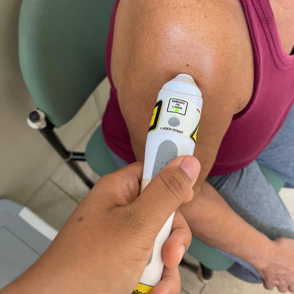 Fotografia registra um aparelho de emissão de laser sento utilizado no braço de uma pessoa.